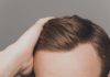 Hair Transplant Procedure and Cost hair transplant cost and treatment