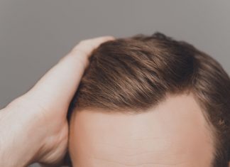 hair transplant cost and treatment