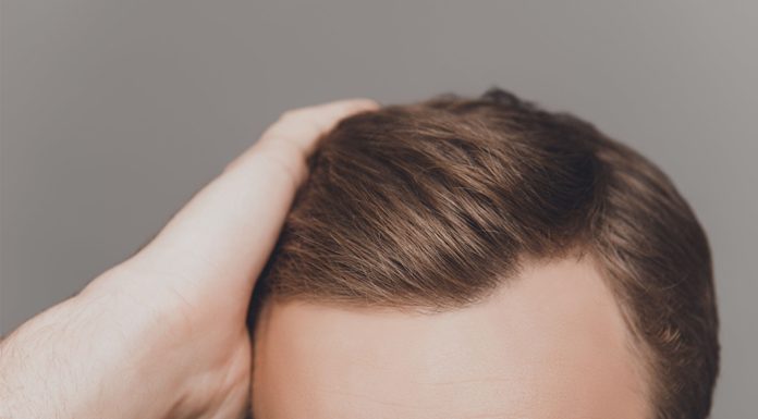 hair transplant cost and treatment