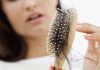 Hair Loss Cure for Telogen Effluvium telogen effluvium hair loss