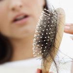 telogen effluvium hair loss