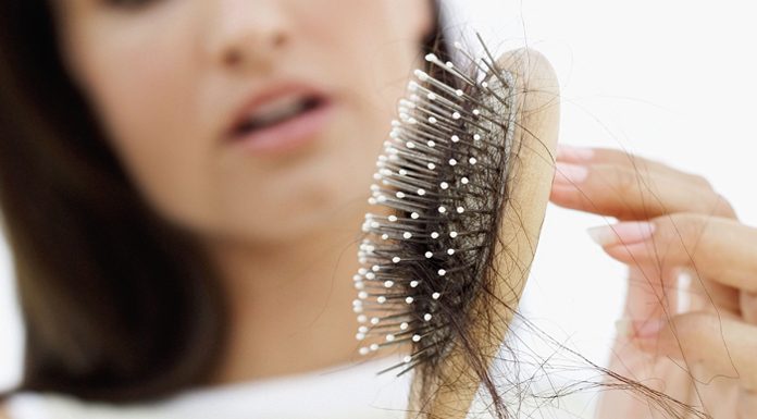 telogen effluvium hair loss