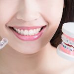 types of false teeth and alternatives