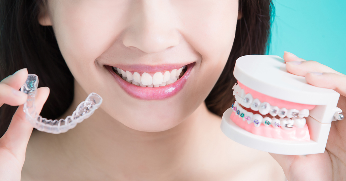 What is False Teeth and How to Maintain Artificial Teeth