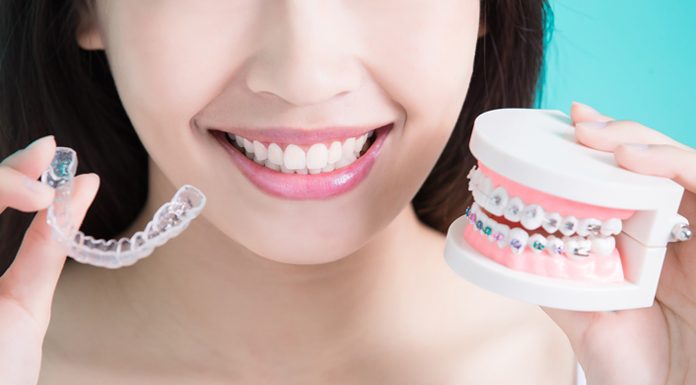 What is False Teeth and How to Maintain Them what is false or fake teeth