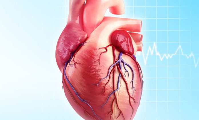 what is a heart ct scan