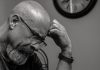 Bulging Forehead Veins: Causes and Treatment bulging forehead veins